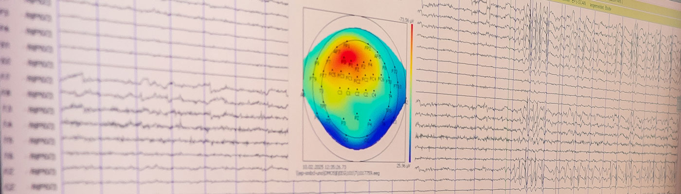 Ueber Epilepsie 1400x400